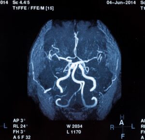 John Foy Atlanta Brain Injury Lawyer