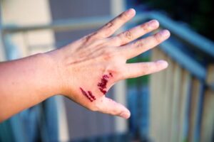 Brunswick Dog Bite Lawyers | John Foy & Associates Brunswick Dog Bite Lawyer