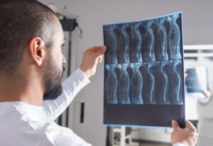 Making an injury claim for a spinal cord injury after an accident in georgia