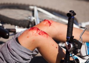 When Should You Get a Lawyer For a Bicycle Accident?