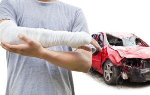 Columbus Broken Bones Lawyers | Car Accidents | John Foy & Associates Columbus Broken Bones Lawyers