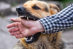 Why Do I Need a Lawyer for My Dog Bite Injury Case?