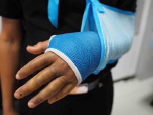 Mableton Broken Bones Lawyers | Millions Recovered | Free Consultations A broken arm rests in a cast and is supported by an arm sling.