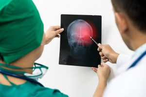 nurse and doctor looking at x-ray of head