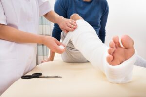 Slip-and-Fall Lawyer in Griffin, GA | John Foy A doctor puts a cast on an injured person’s leg.