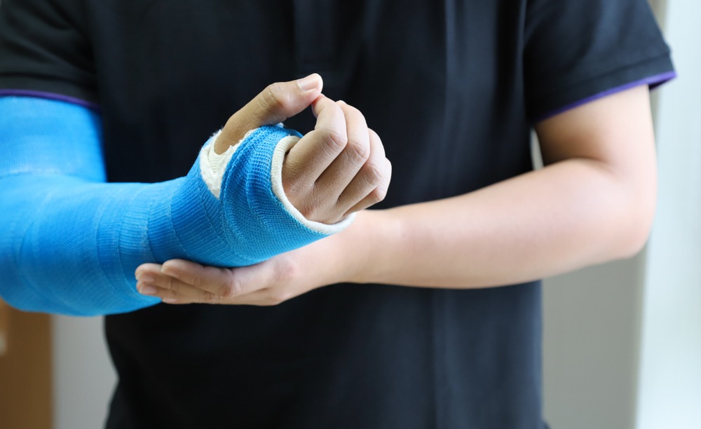 An injured man holds his arm in a cast