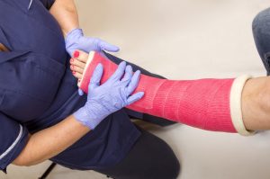 doctor treating a woman in a leg cast