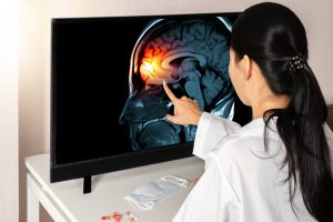 female doctor checking brain scan on monitor