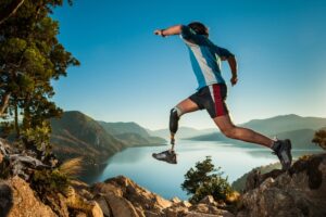 Catastrophic Injuries Lawyers in Dawsonville | Free Eval man with a prosthetic leg