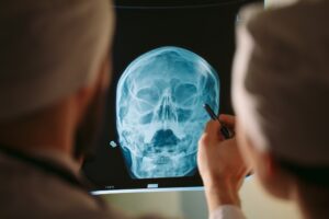 Traumatic Brain Injury Lawyer in East Point | Free Eval doctor going over head x-ray with a patient