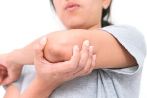 Can You Get Workers’ Comp for Tennis Elbow in Georgia?