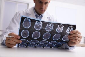 Whiplash vs. Concussion: What Are the Differences?