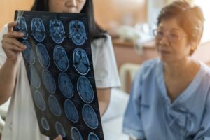 Signs & Symptoms of Concussion After a Car Accident